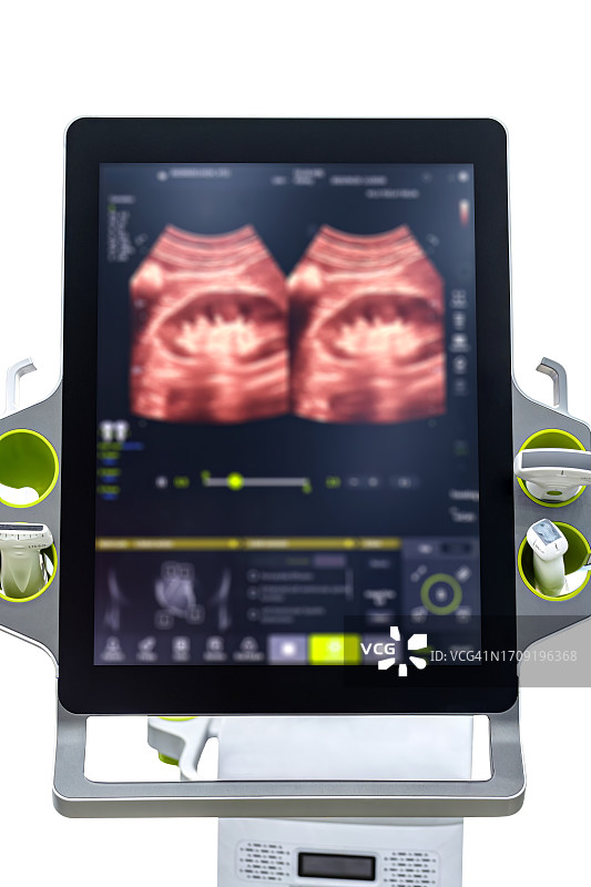 白色背景超声波扫描怀孕图片素材
