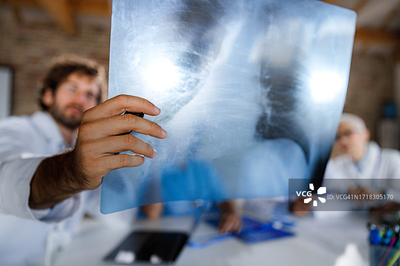 检查肺部X光片图片素材