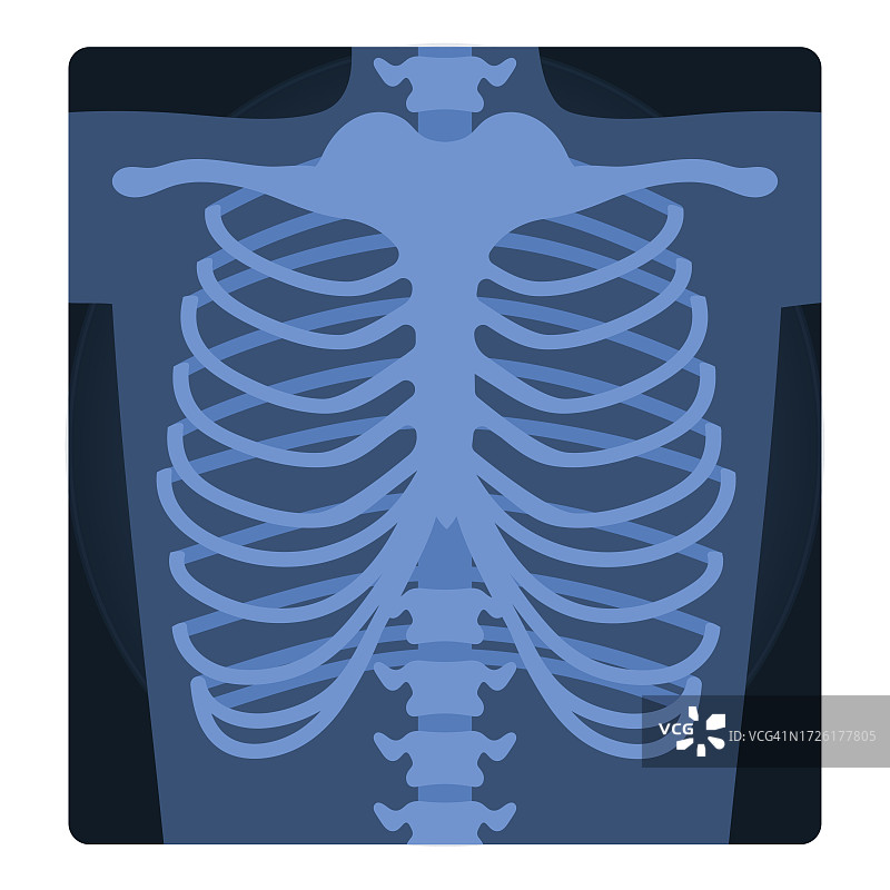 人体胸部X光医疗扫描图片素材