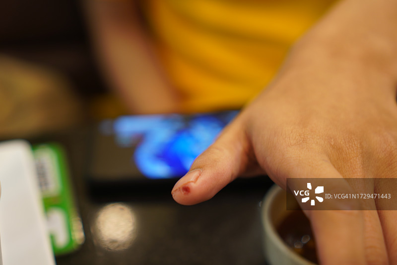 男人拇指上的刀伤正在流血图片素材