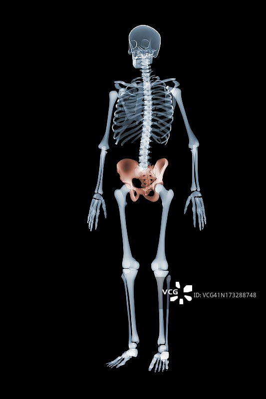 带有红色臀部的骨骼X光正面图图片素材