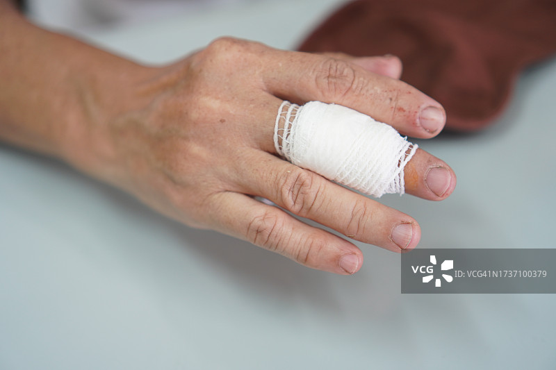 女士用绷带包扎中指图片素材