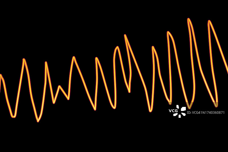 尖端扭转型室性心动过速心律图片素材