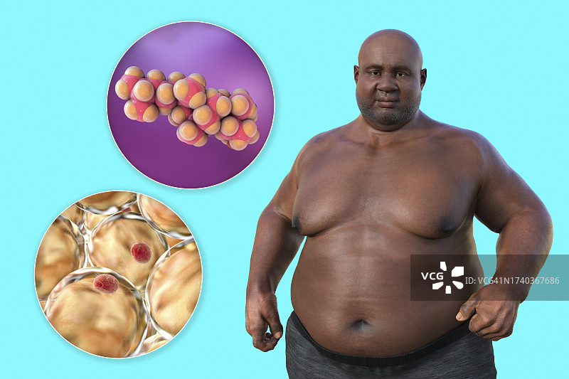 超重男子的脂肪细胞，插图图片素材