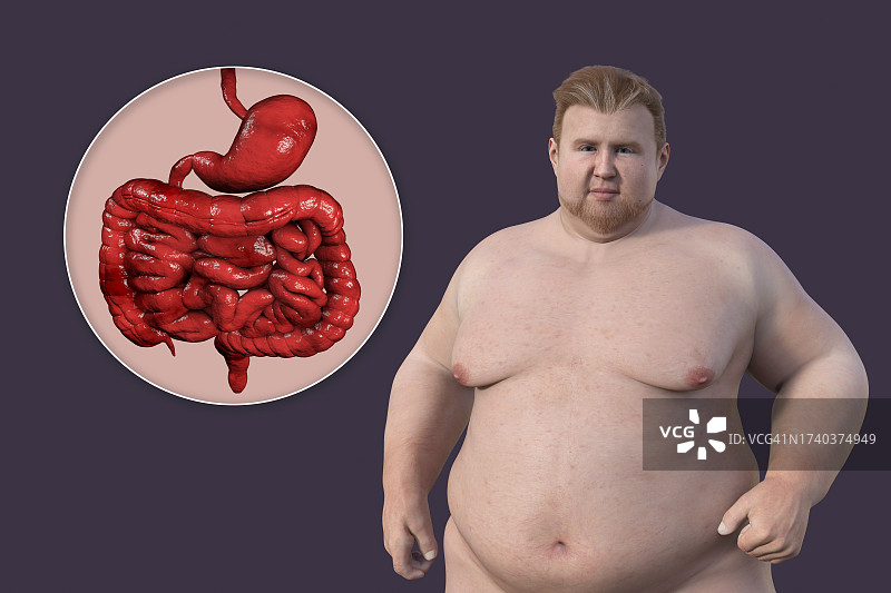 肥胖男人的消化系统插图图片素材