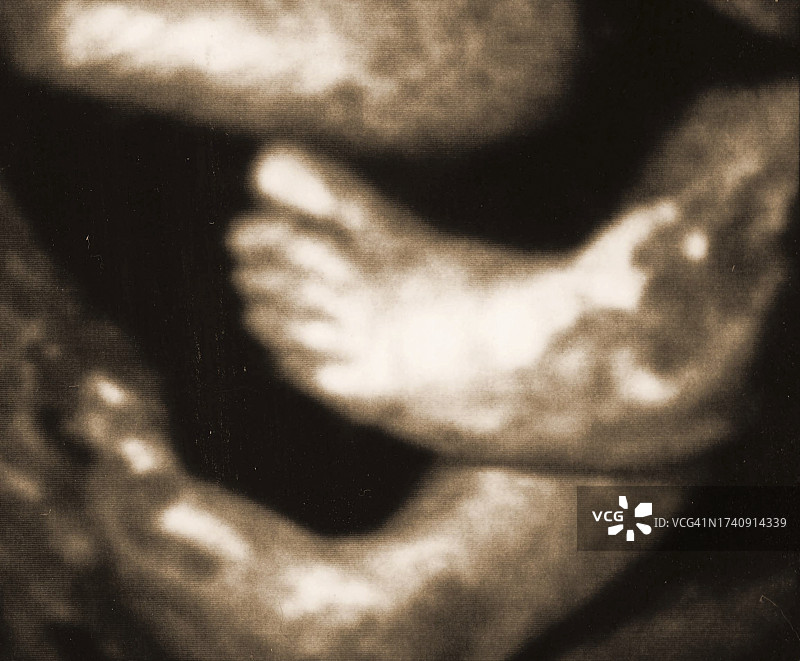 探险家Kypros之子Kypros在出生前图片素材