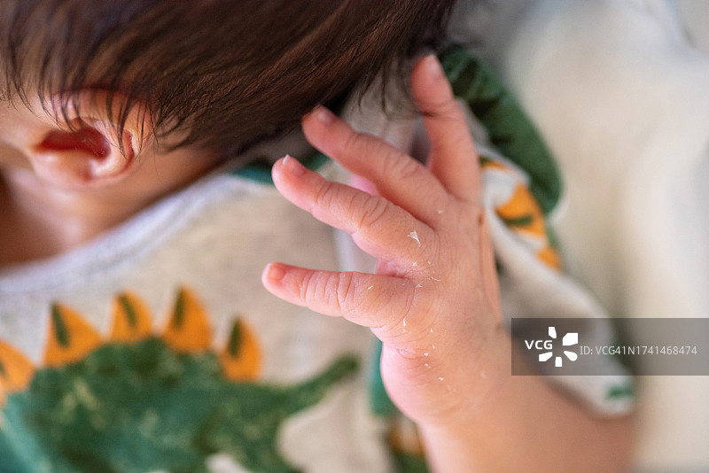 新生儿脱皮（一周大男婴）图片素材