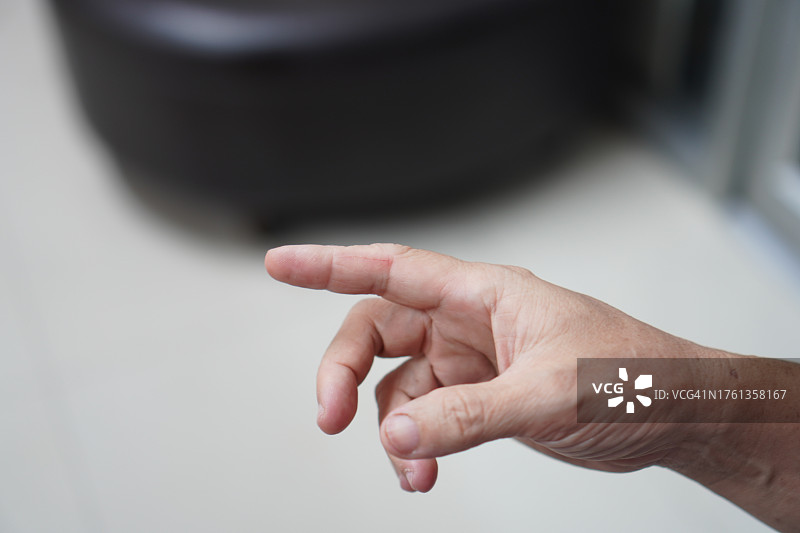 刀割伤食指图片素材