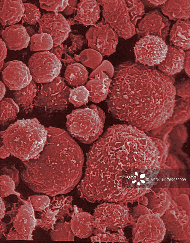 扫描电子显微镜下的骨髓细胞照片图片素材