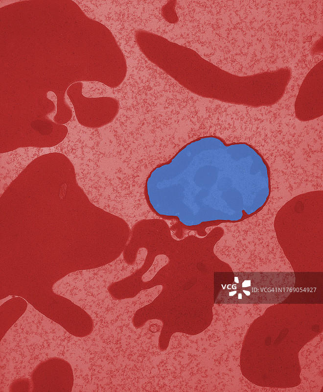 透射电子显微镜下的未成熟红细胞照片图片素材