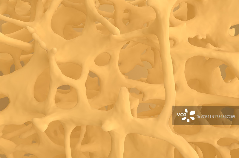 骨质疏松骨组织插图图片素材