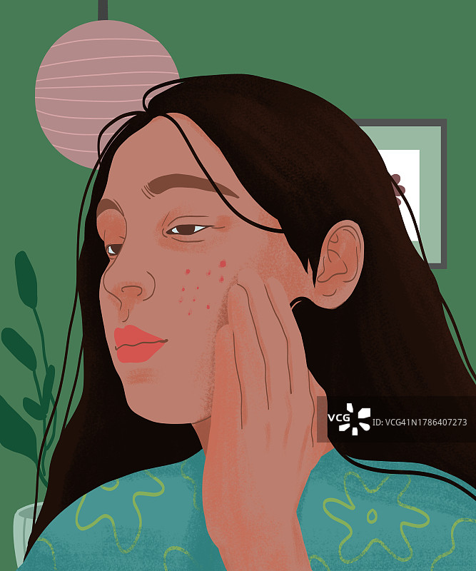 患有痤疮的女性插画图片素材