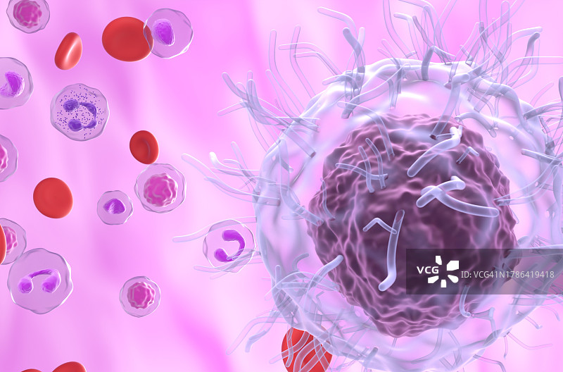 毛细胞白血病插图图片素材
