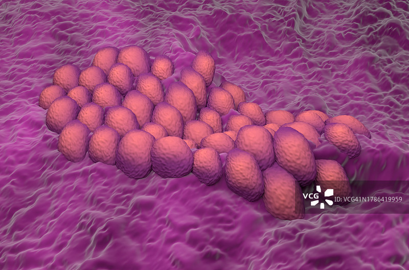 子宫内膜癌插图图片素材