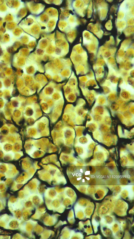 结缔组织——网状结缔组织，脾脏，250X图片素材