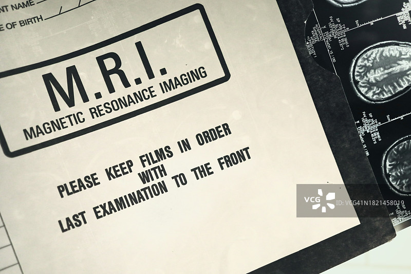 用于医疗保健的核磁共振图像图片素材