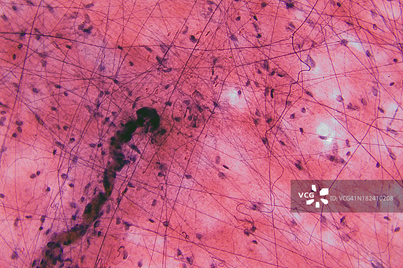 疏松结缔组织图片素材