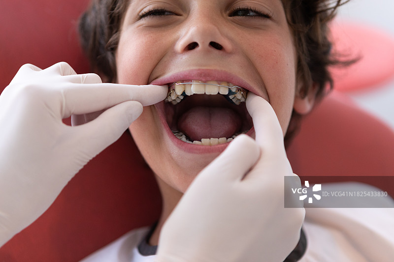 牙医和少年患者在牙科咨询期间图片素材