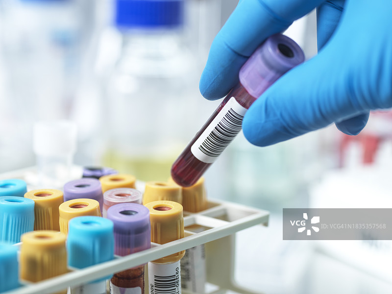 病理学家在实验室手持试管样本图片素材