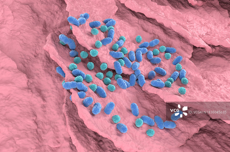 真菌性皮肤感染插图图片素材
