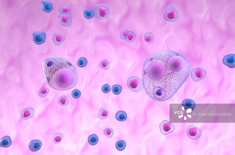 神经细胞中的路易体，图示图片素材