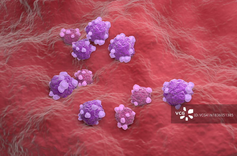 卵巢癌插图图片素材