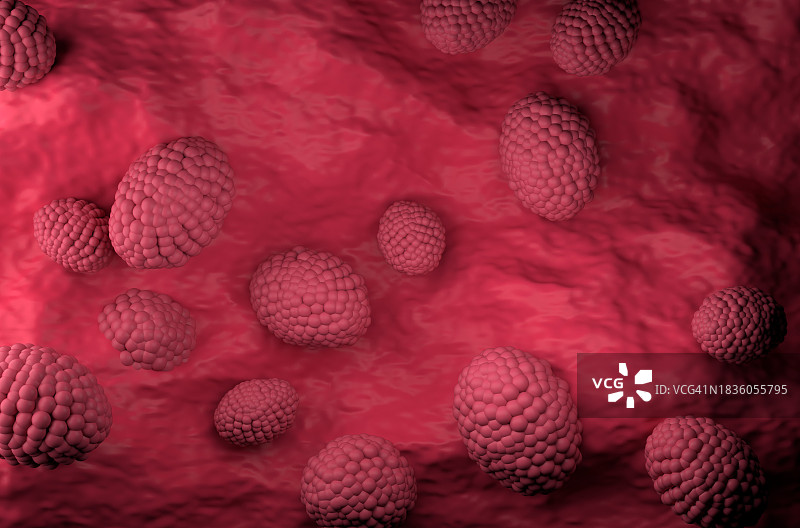 前列腺癌插画图片素材