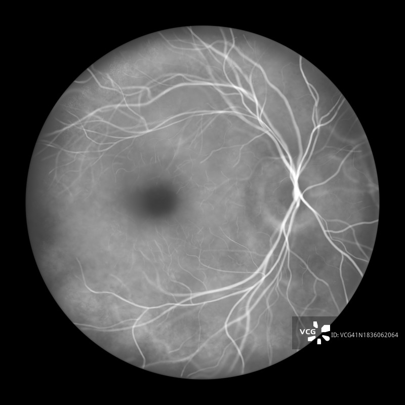 健康视网膜插图图片素材