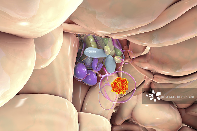 脑垂体肿瘤插图图片素材
