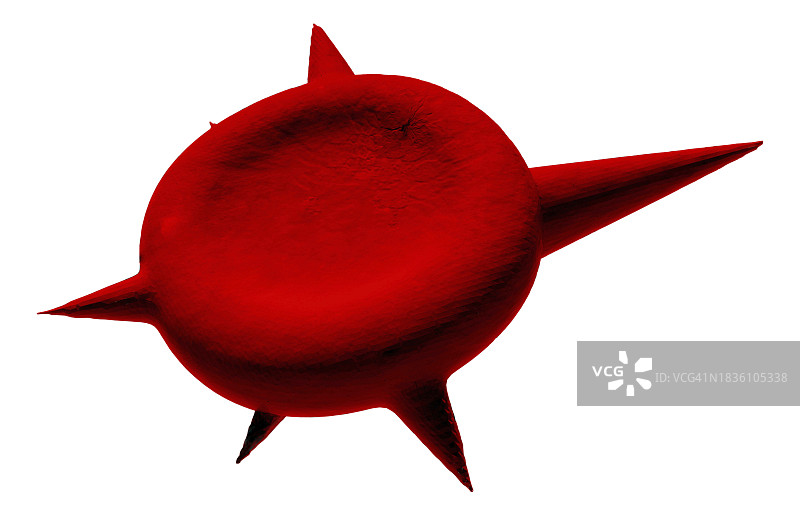 棘细胞异常红细胞插图图片素材