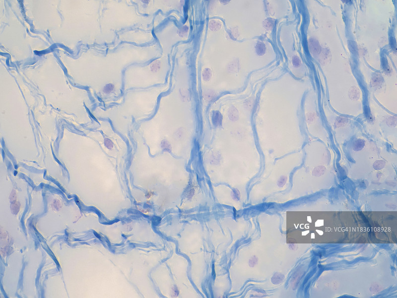 疏松结缔组织显微照片图片素材