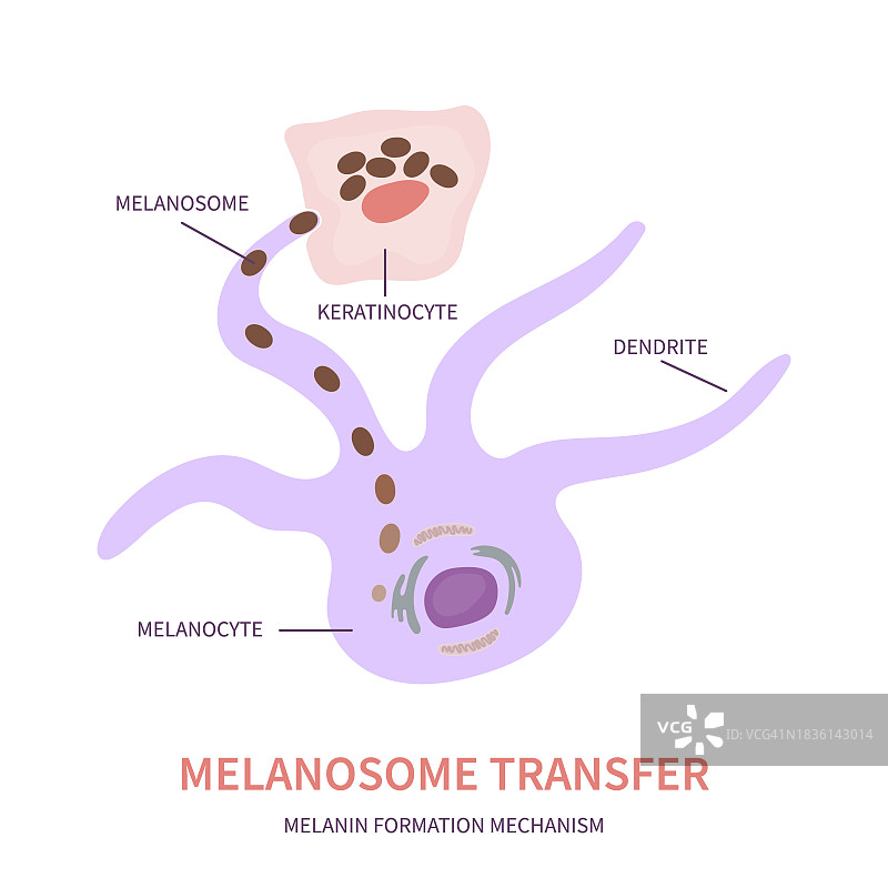 皮肤色素沉淀概念图图片素材