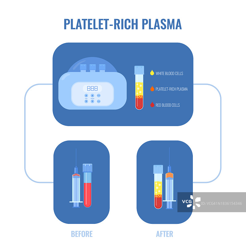 血浆概念图图片素材
