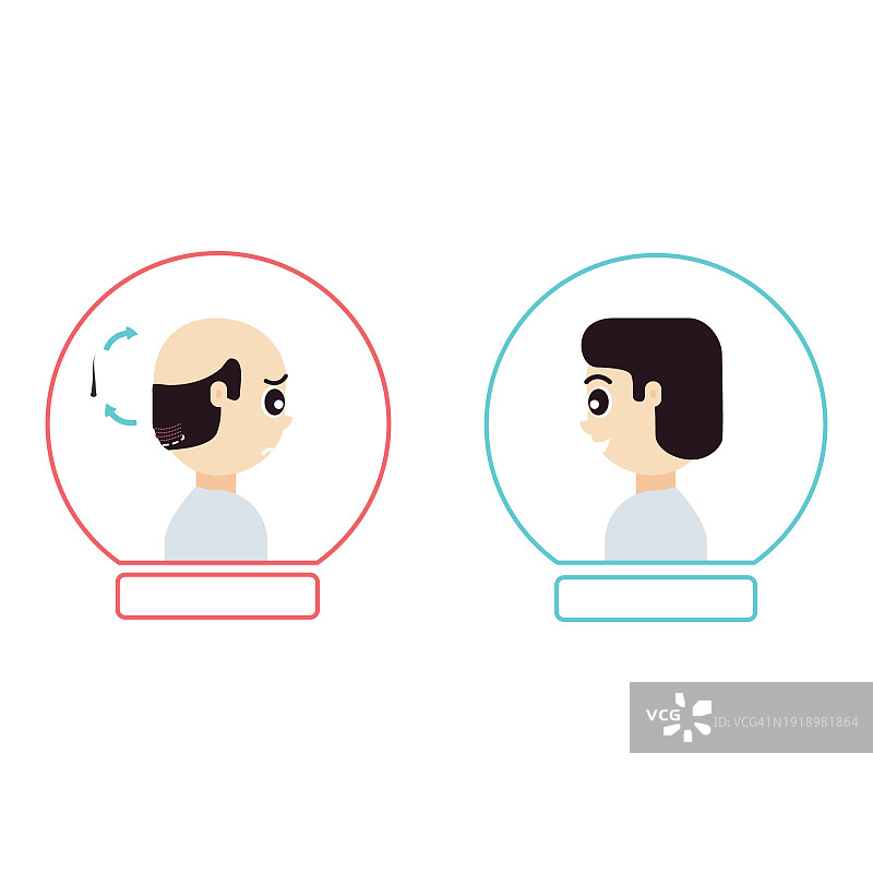 植发概念插图图片素材