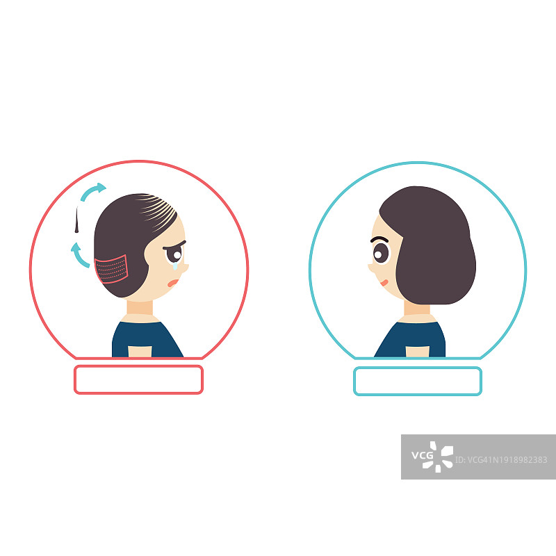 植发概念插图图片素材