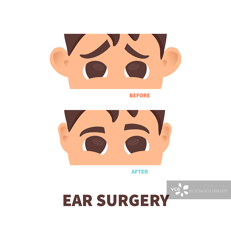 耳部手术概念图图片素材