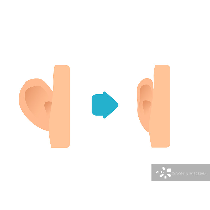 耳廓成形术概念图图片素材