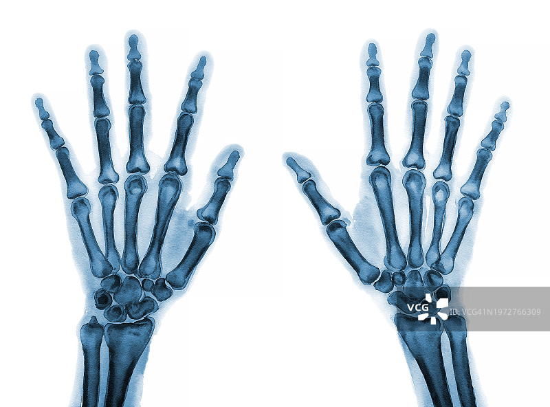 女人手部特写图片素材