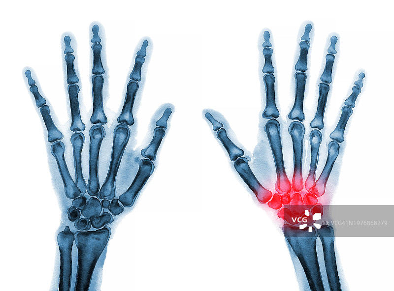 女士手部 02图片素材