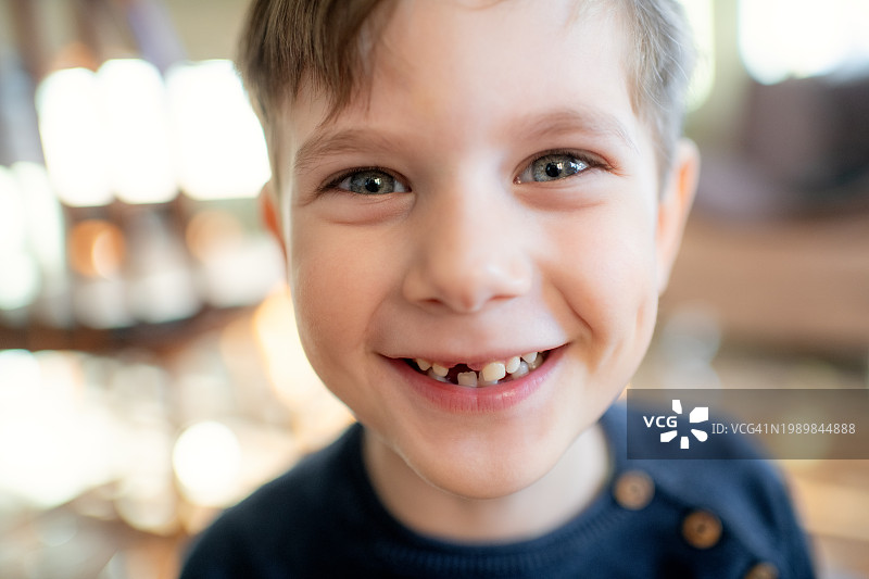 露出乳牙缝隙的可爱小男孩图片素材
