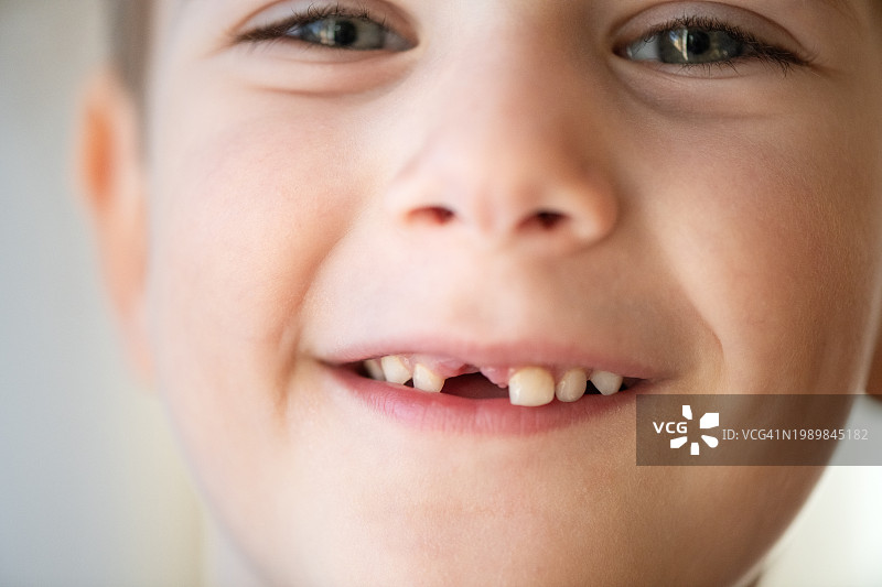 露出乳牙缝隙的可爱小男孩图片素材