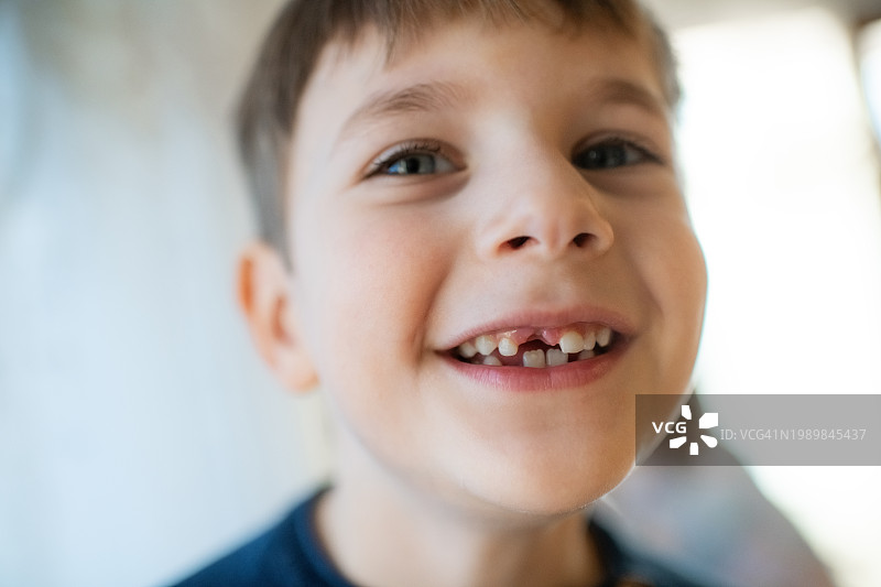 露出乳牙缝隙的可爱小男孩图片素材