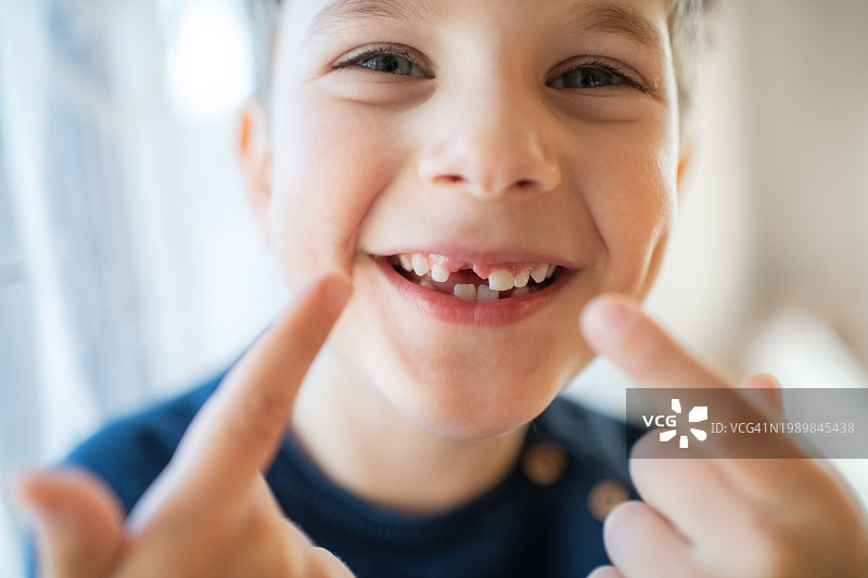 露出乳牙缝隙的可爱小男孩图片素材