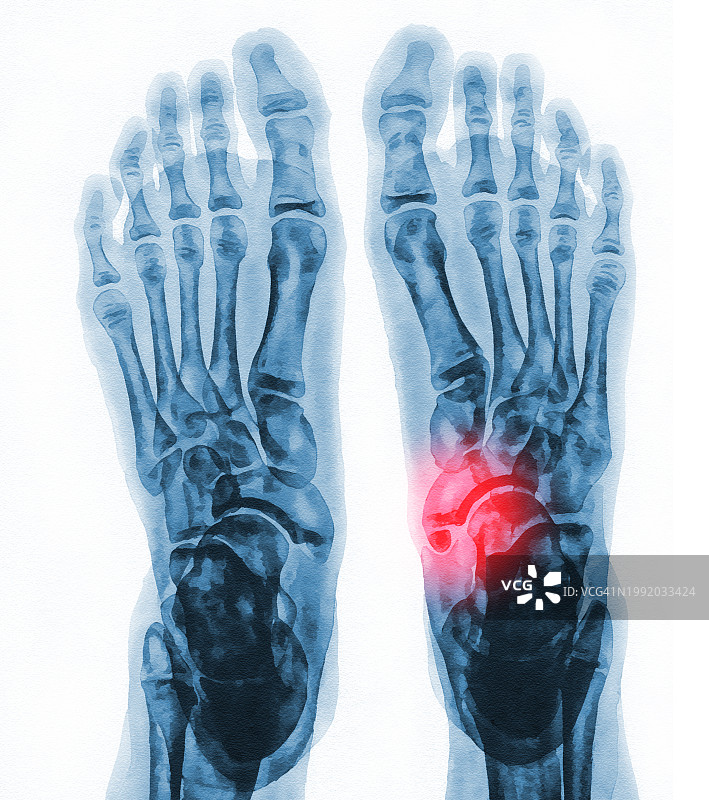 女人的脚 02图片素材