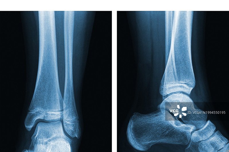 女人的脚 06图片素材
