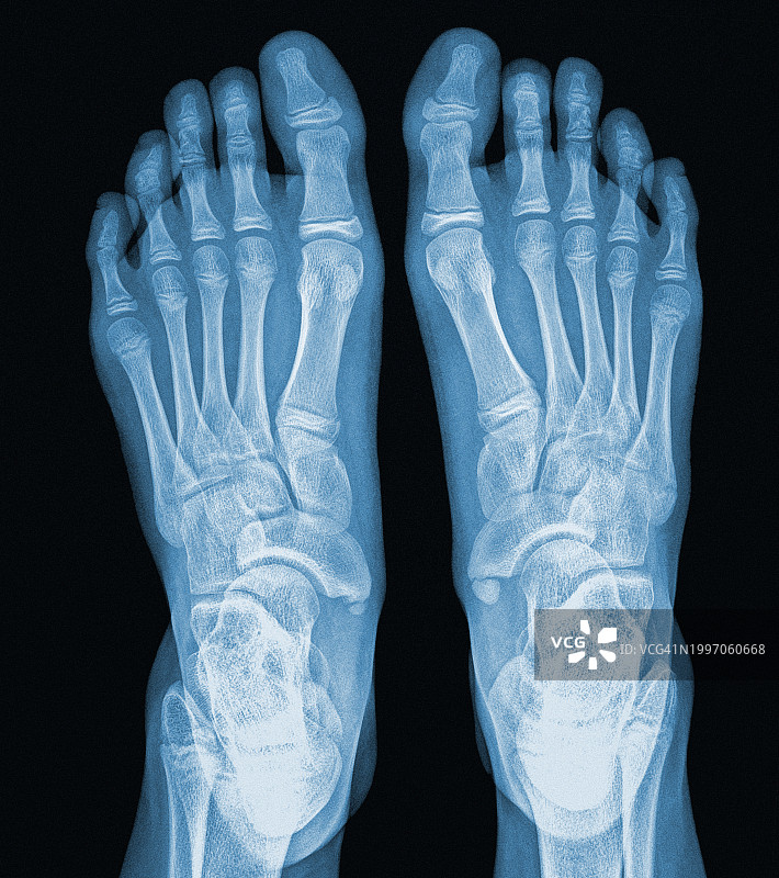 女人的脚图片素材
