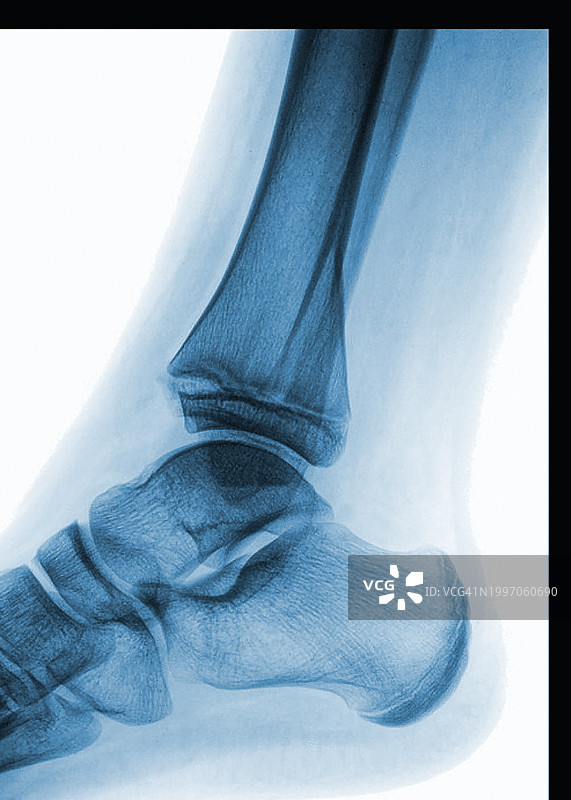 女人的脚图片素材