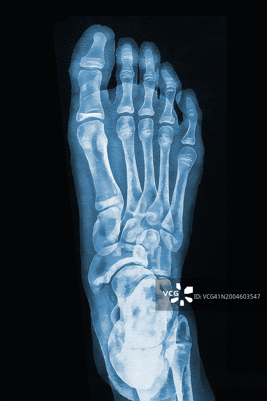 女孩的脚图片素材