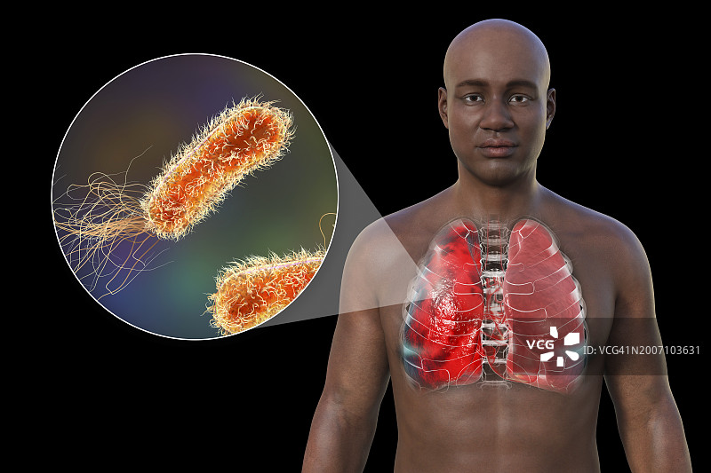 肺炎影响肺部的男人插画图片素材