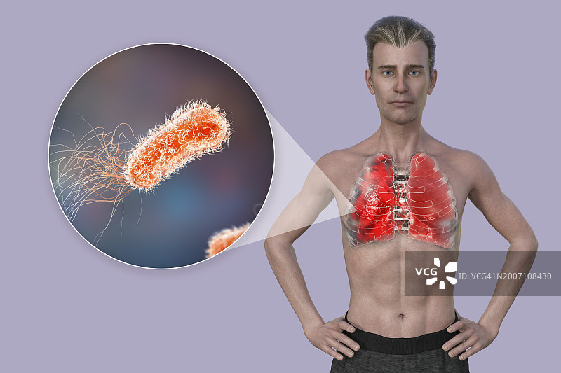 肺炎影响肺部的男人插画图片素材